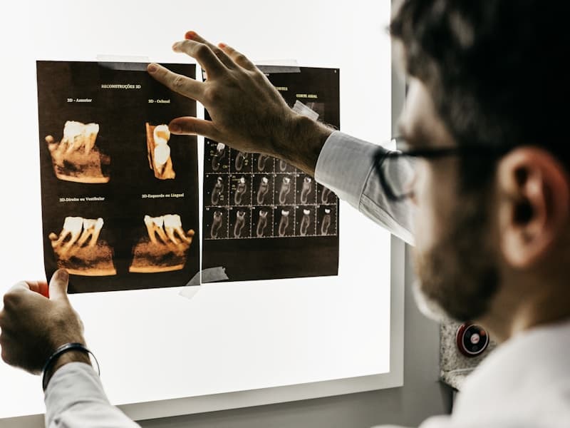 Dental Bridges in İzmir, Turkey